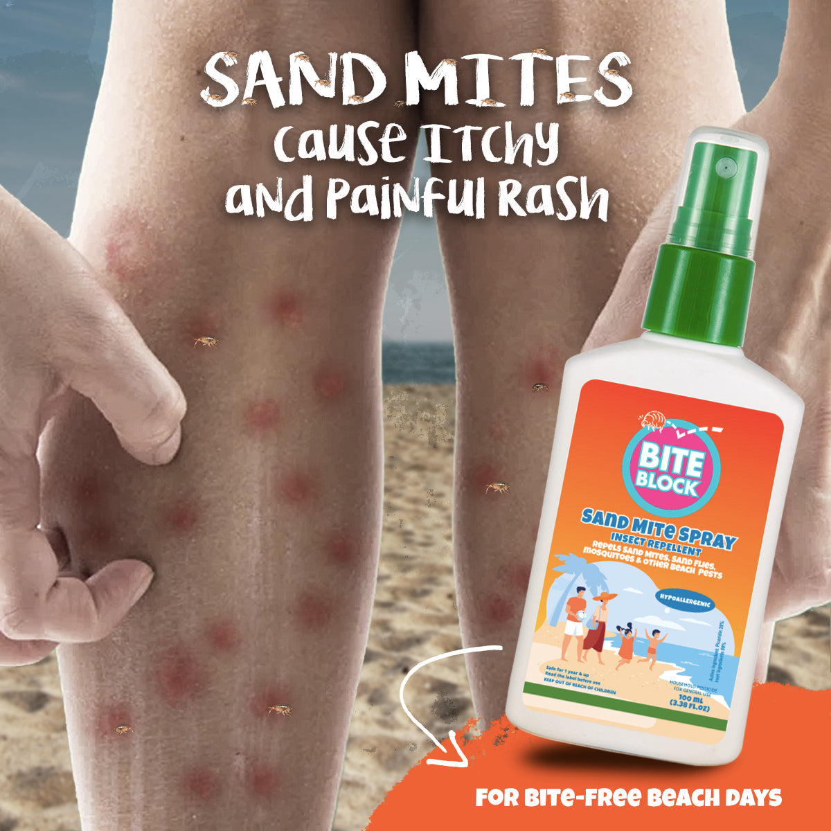 Bites from sand mites can cause itchy and painful rash, fever, and sand mite-borne diseases  Protect yourself from these painful bites and have a bite-free beach day!